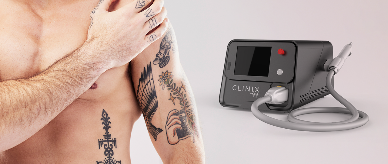 CLINIX na prática: remoção de tatuagem com mais previsibilidade e menor agressão à pele!