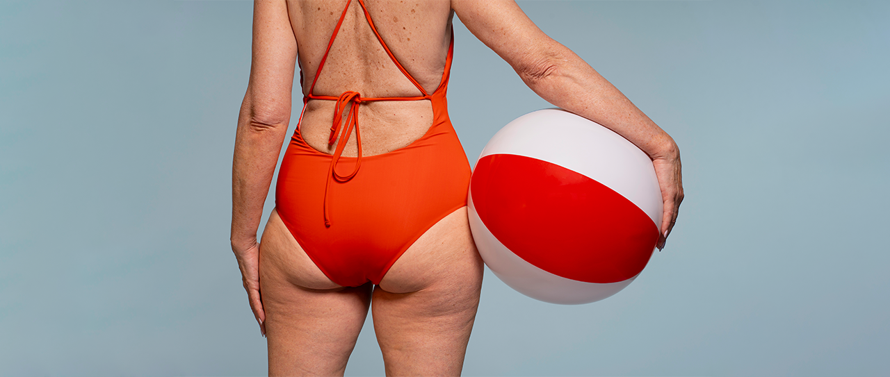 Lipedema no verão: Criolipólise + Criofrequência e suporte Ozon Prime para potencializar resultados!