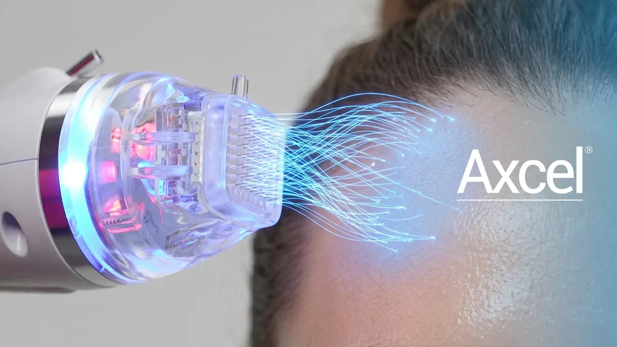 Microagulhamento associado à radiofrequência para estímulo de colágeno e rejuvenescimento da pele.