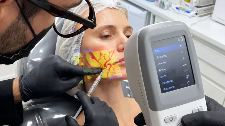 Scanner de veia projetando mapa vascular sobre a pele para procedimentos clínicos e estéticos