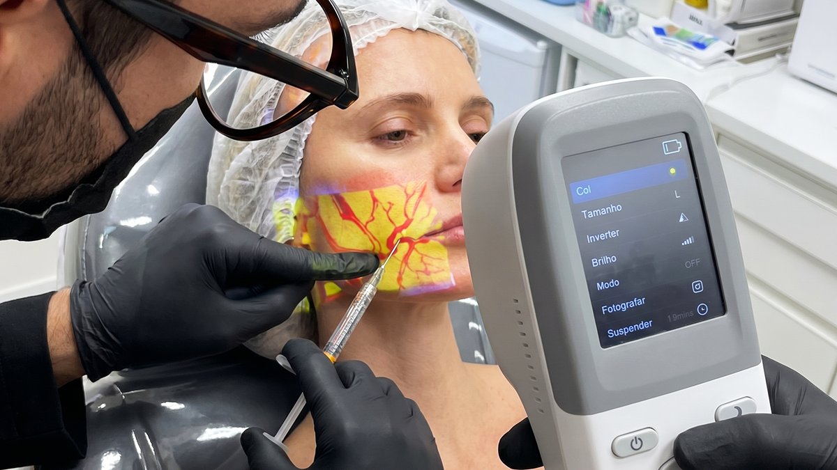 Scanner de veia projetando mapa vascular sobre a pele para procedimentos clínicos e estéticos