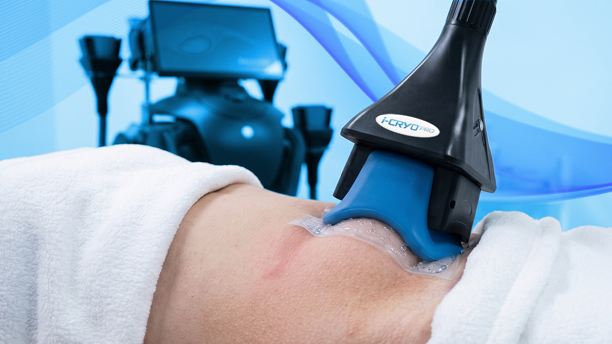 i-CRYO PRO da Fismatek Medical: a evolução da criolipólise inteligente.