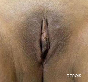 depois